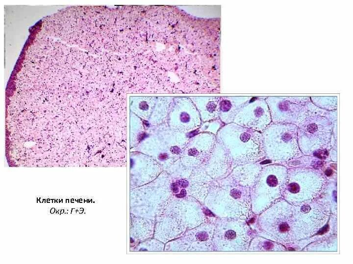Общая морфология клетки печени аксолотля. Клетки печени аксолотля гематоксилин эозин. Препарат общая морфология клетки печень аксолотля. Общая морфология клетки гистология препарат.