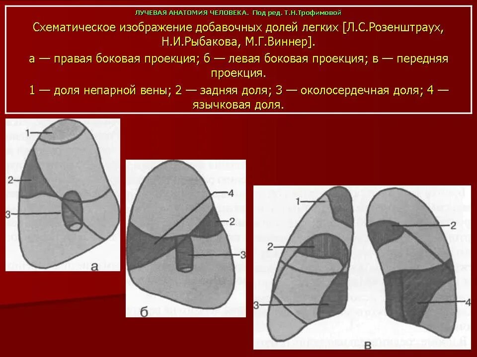 Доли легкого на кт. Доли левого легкого анатомия. Лучевая анатомия легких. Доли легкого на рентгенограмме в боковой проекции. Доли легкого боковая проекция.