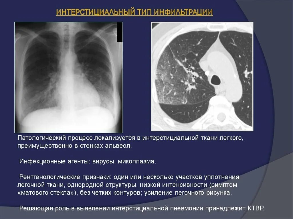 Участок уплотнения по типу матового стекла