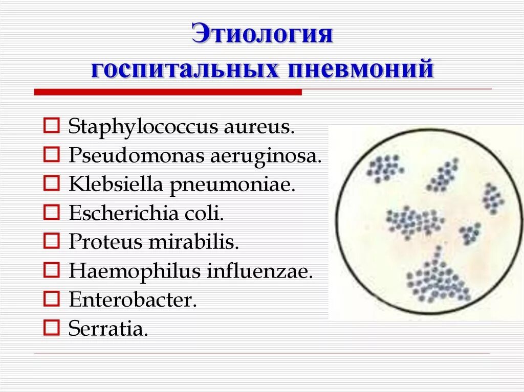 Streptococcus pneumoniae haemophilus influenzae streptococcus