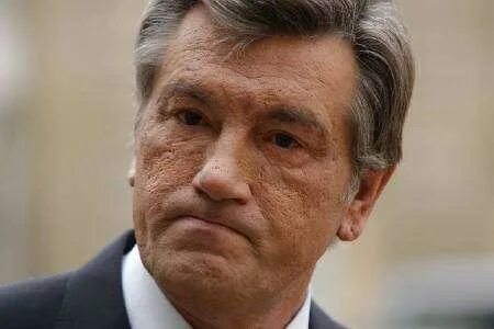 Ющенко лепра. Ющенко 2006. Болезнь у ющенко лепра ющенко. Ющенко лепра. Ющенко лепра.