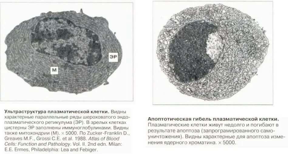 Плазматическая клетка строение. Плазматические клетки плазмоциты. Плазматические клетки гистология. Плазматическая клетка строение. Плазмоцит строение гистология.