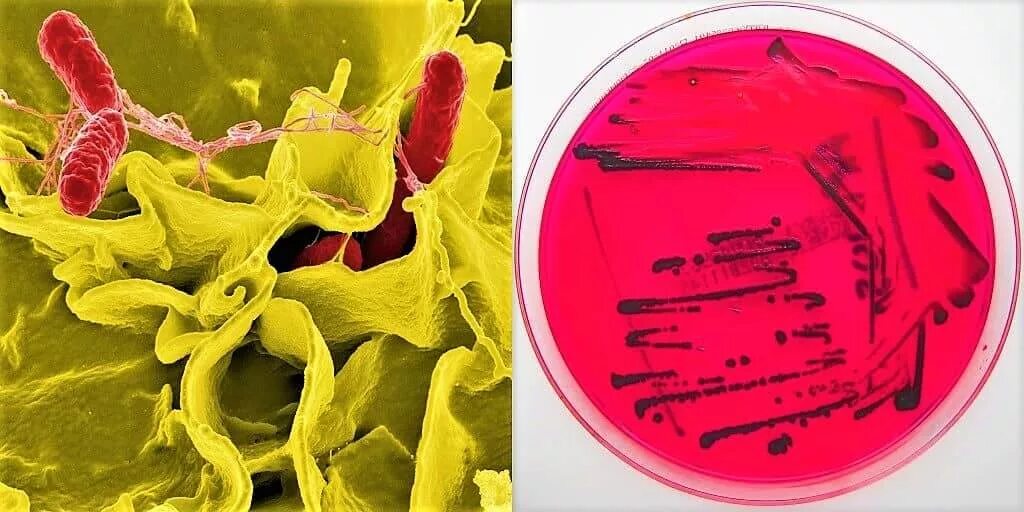 Сальмонелла Тифи морфология. Salmonella typhi возбудитель брюшного тифа. Сальмонелла энтеритидис. Сальмонеллез у собак