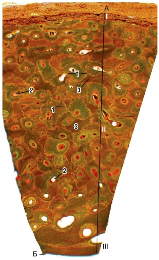 Пластинчатая компактная костная ткань диафиза трубчатой кости. Пластинчатая костная ткань диафиза. Пластинчатая костная ткань поперечный срез диафиза. Пластинчатая костная ткань окраска по шморлю. Пластинчатая кость