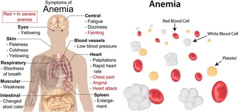 Пита анемия