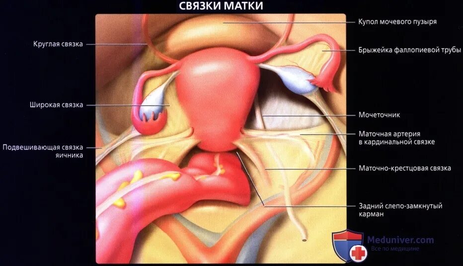 Круглая связка матки. Круглая связка матки расположение. Связки матки анатомия. Кпуглвясу связка матки. Где находятся круглые связки