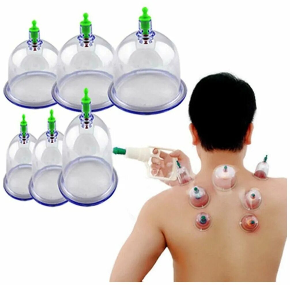 вакуумные банки "хиджама". банки лечебные вакуумные. банки на спину стеклянные. баночки для хиджамы. Ys-0012а вакуумные банки с вакууматором №12 (в упак.