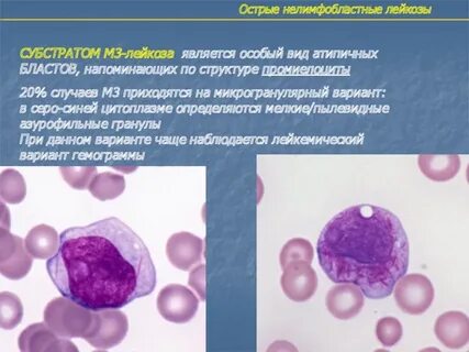 Лейкозы клинические рекомендации