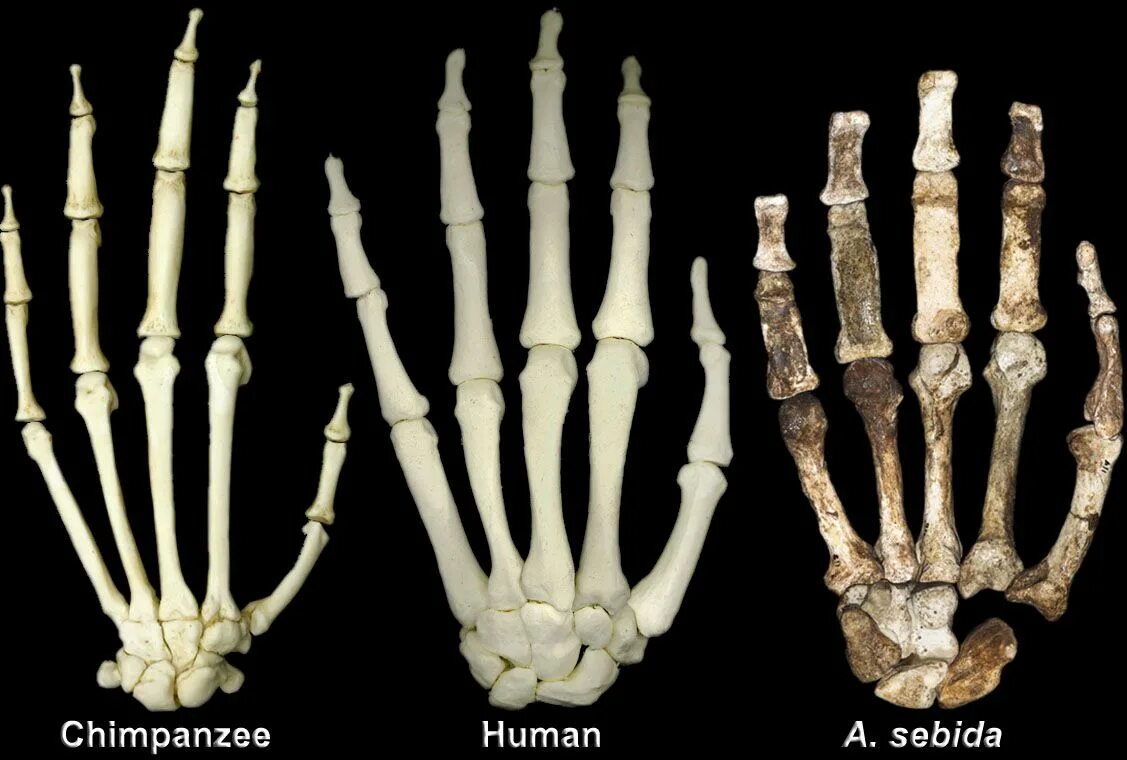 Строение кисти шимпанзе и человека. Строение кисти австралопитека. Кости руки. Скелет кисти. Hand bone