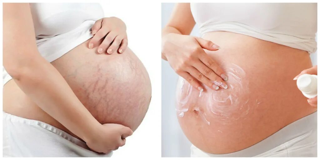 9 месяц беременности роды. 6 Месяц беременности. Живот на 7 месяце беременности. Живот на 9 месяце беременности. Живот у беременных на 7 месяце.