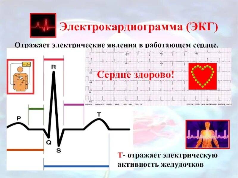 ЭКГ. Электрокардиограмма. Электрокардиограмма отражает. Электрические явления в сердце ЭКГ.
