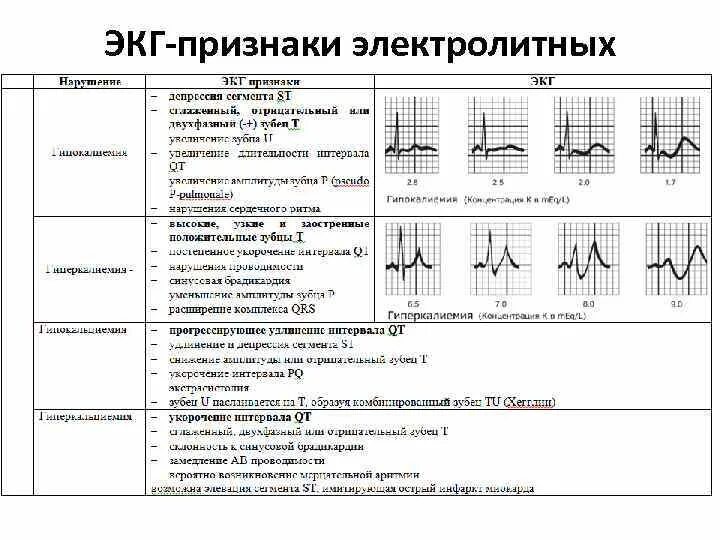 Расшифровка показателей экг сердца взрослого норма. Зубцы и интервалы экг расшифровка. Что брать с собой на экг. Понятие «нормальная экг. Экг.