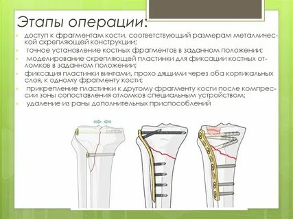 Шаг операции