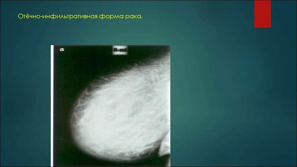 рмж обозрение