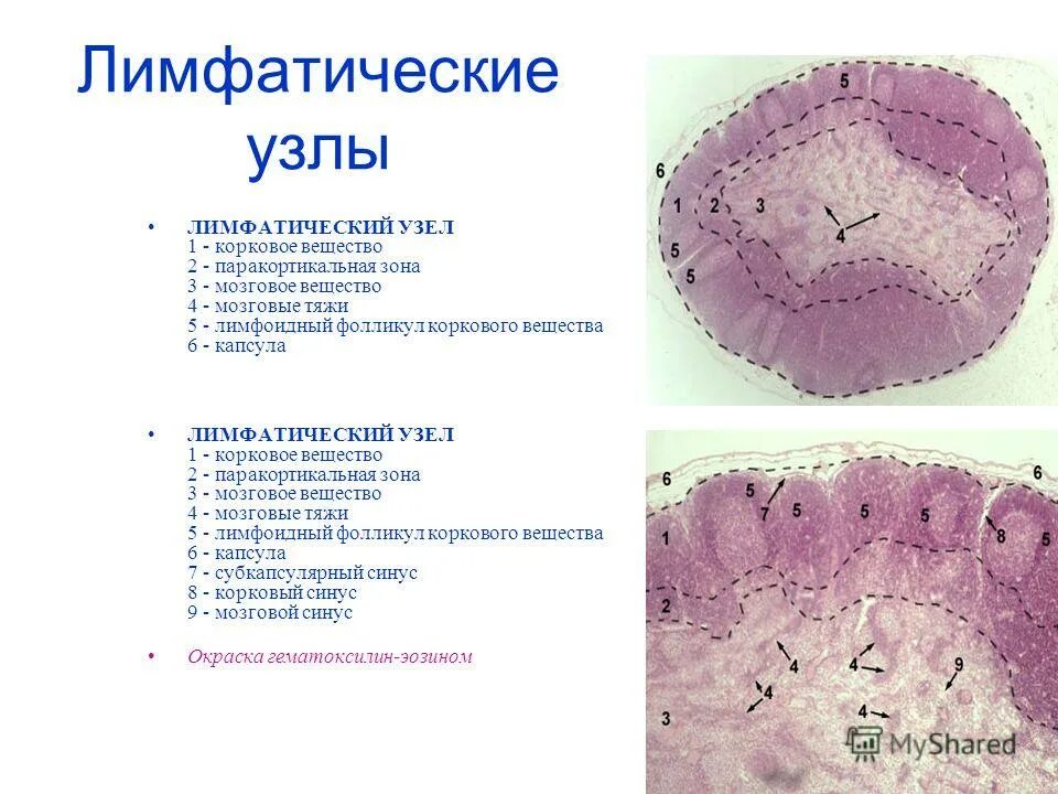 гистологическое строение лимфатического узла. краевой синус лимфатического узла препарат. строение лимфатического узла анатомия. строение лимфатического узла таблица. корковый лимфоузел.