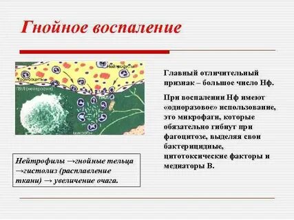 Очаговое гнойное воспаление