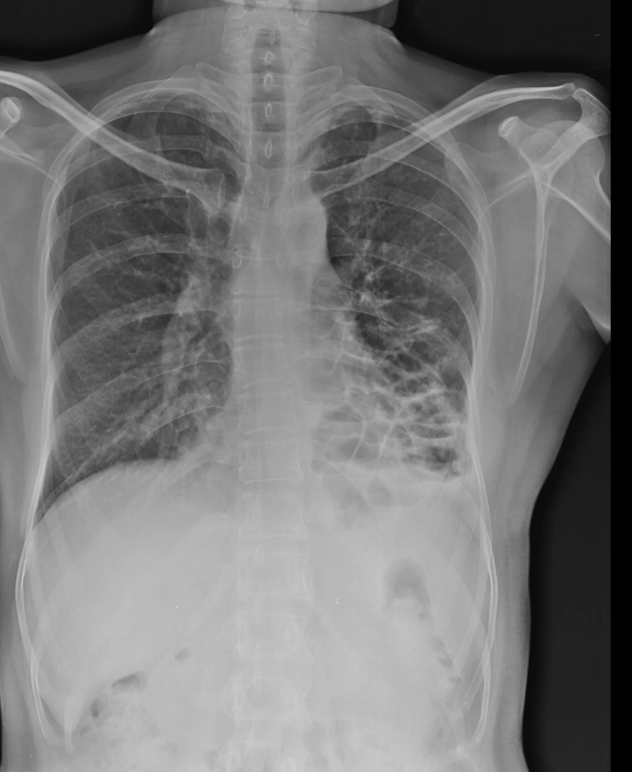 Source x rays