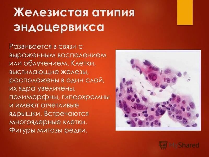 цитология без атипии