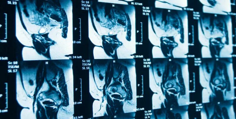 Кт органов таза у мужчин. Магнитно-резонансная томография органов малого таза. Мрт малого таза Сергея Березина. Мрт малого таза расшифровка снимков. Мрт малого таза снимки.