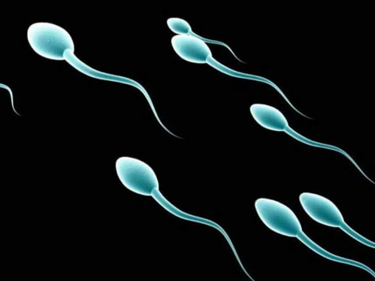 Женские спермии. Мужское семя ребенку. Много и мало сперматозоидов. Sperm.