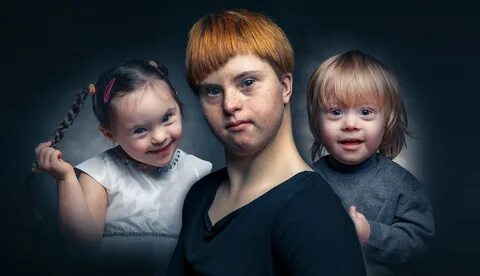 Какие дети дауны