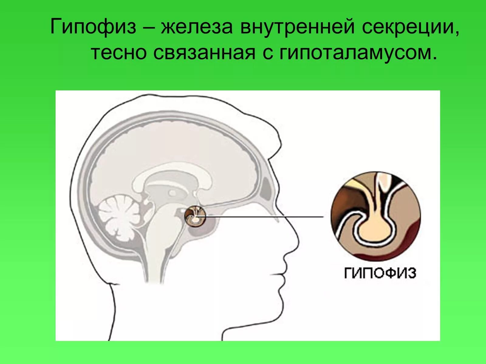 Краниофарингиома гипофиза. Гипофиз расположение в голове. Место гипофиза в голове.