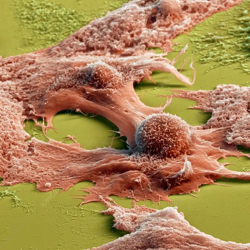 Клетки печени мыши. Звездчатые ретикулоэндотелиоциты печени. Звездчатые клетки печени. Купферовские клетки печени. Звёздчатый РЕТИКУЛА ндотелиациты.
