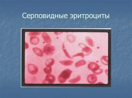 Б патологии