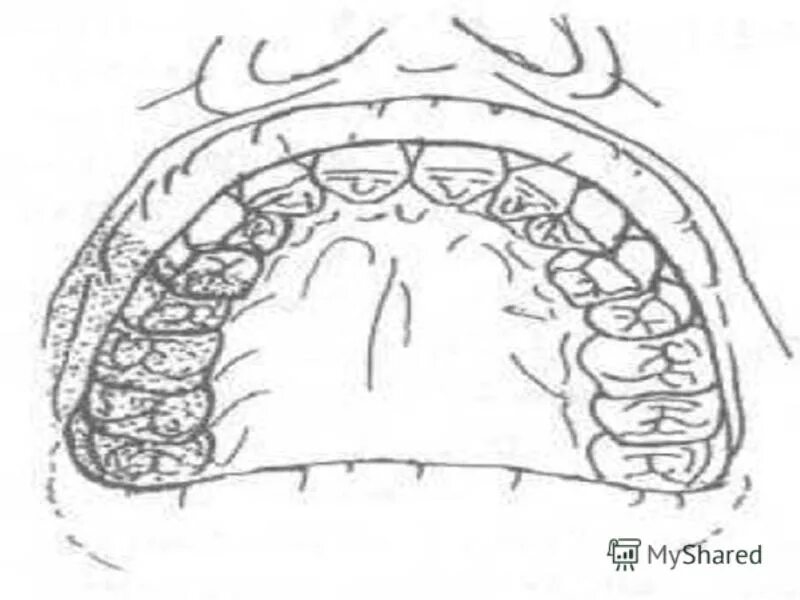 обезболивание в челюстно лицевой хирургии