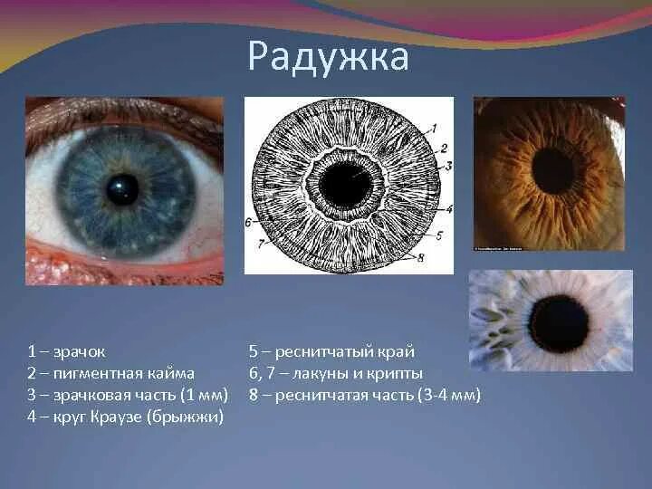 Радужка зрачковая кайма. Брыжжи на радужке. Атрофия пигментной каймы Радужки.