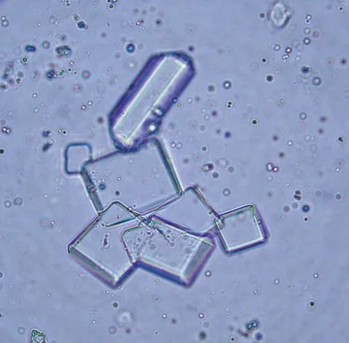 Растворение струвитов. Струвиты в моче. Струвиты в моче у кота. Струвиты Кристаллы кошек. Струвит микроскоп.