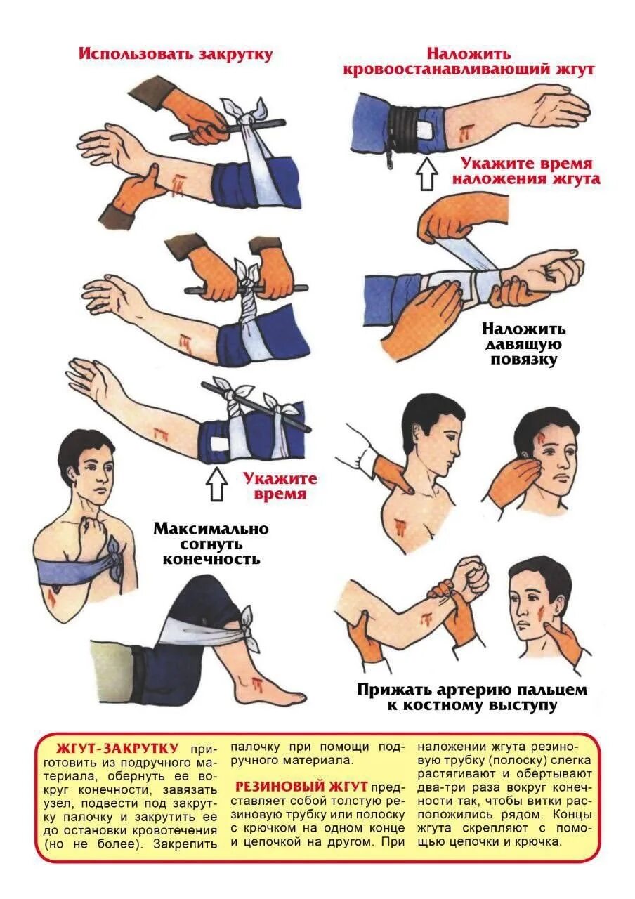 При каких кровотечениях необходимо наложить жгут. Остановка кровотечения. Способы остановки кровотечения. Остановка кровотечения первая помощь. Способы остановки кровотечения при ранении.