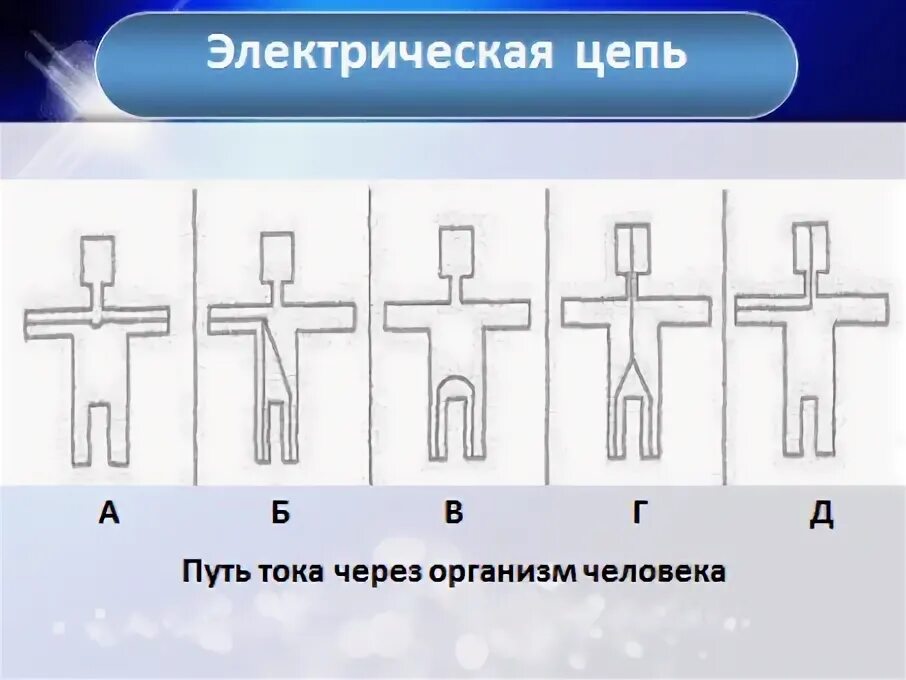 Какие петли тока наиболее опасны. Прохождение тока через тело человека. Пути прохождения электрического тока через тело человека. Схемы прохождения электрического тока через тело человека. Наиболее опасный путь тока через тело человека.