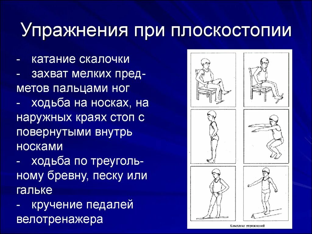 Комплекс упражнений при плоскостопии. Комплексупражнений при пооскостопии. Комплекс лечебной гимнастики при плоскостопии. Комплекс упражнений для плоскостопия.