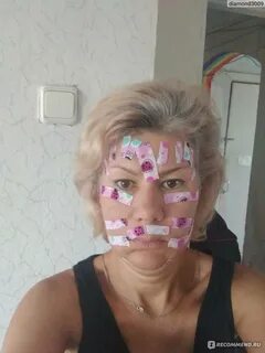 Тейпирование лица помогает