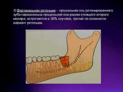 Вертикальная ось зуба
