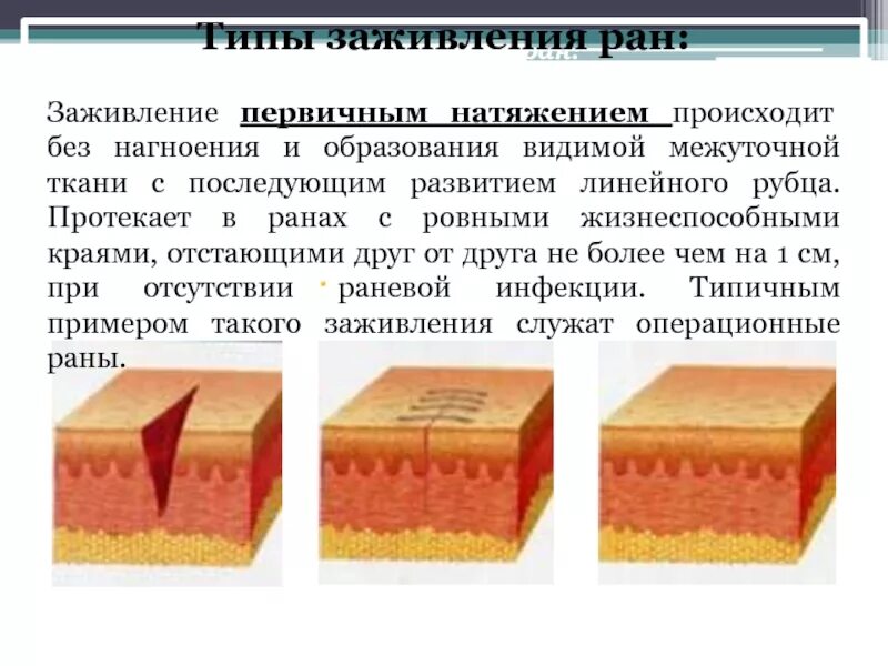Как заживить быстрей