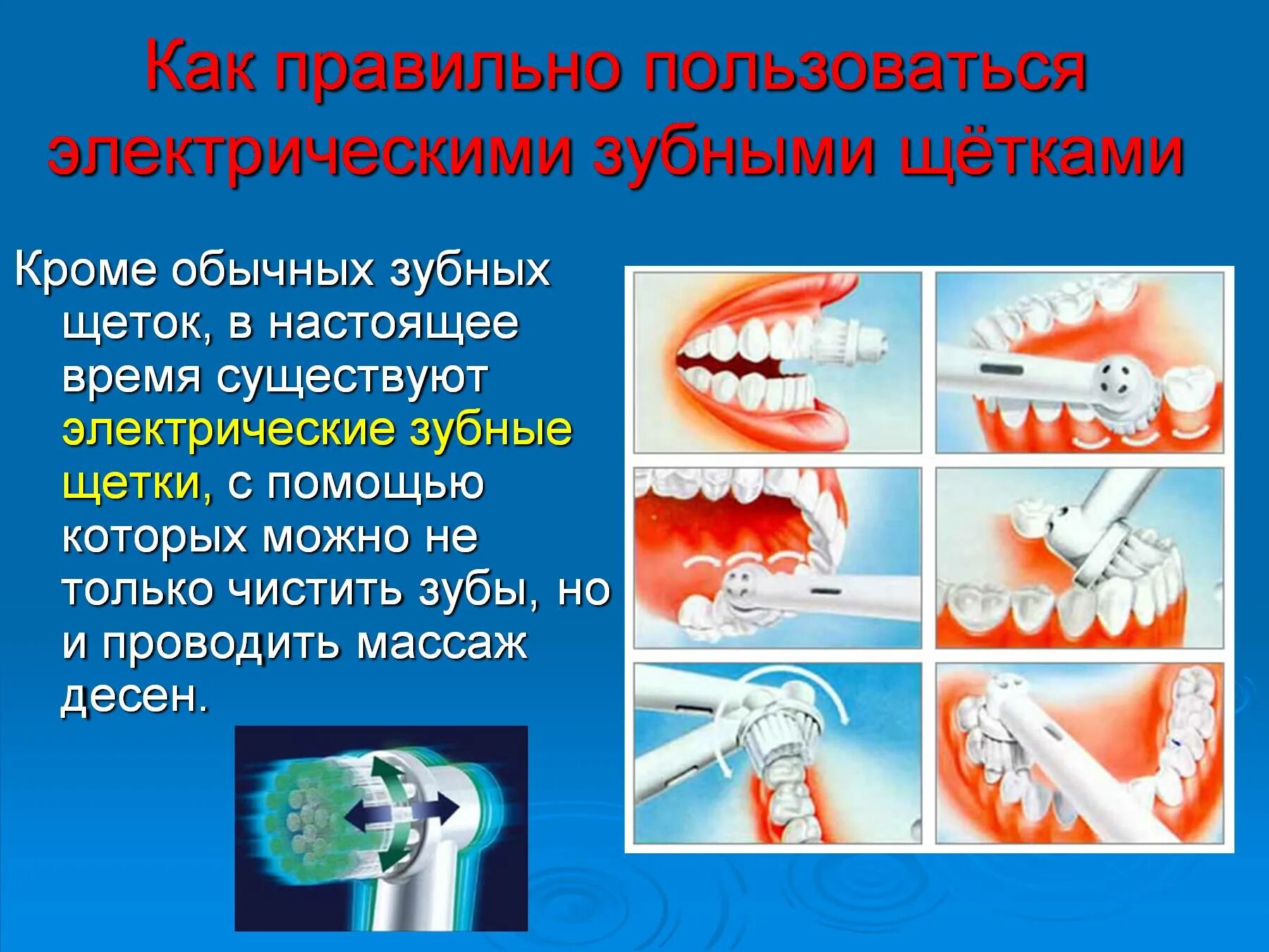 Когда лучше чистить зубы. Правильная методика чистки зубов зубной щёткой. Правильная техника чистки зубов электрической щеткой. Как правильно чистить зубы электрической щеткой. Метод чистки зубов электрической щетки.