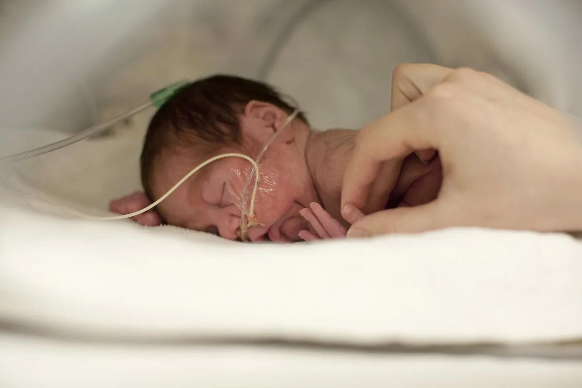 6 месячные недоношенные дети. Новорождённые малыши в роддоме. На какой неделе можно родить жизнеспособного ребенка. Рождение 8 месячных ребёнок. Недоношенный новорожденный.