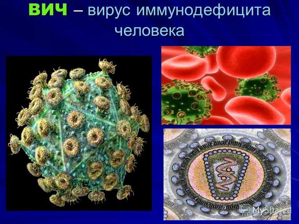 Вирус иммунодефицита человека под микроскопом. Вич бактерия. Коронавирус клетка. Вирус вич. Вирус иммунодефицита человека:вирус иммунодефицита человека.