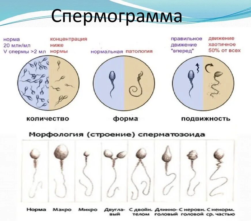 После полового акта второй. Астенозооспермия показатели спермограммы. Агглютинация спермограмма. Нормальные сперматозоиды. Патология сперматозоидов.