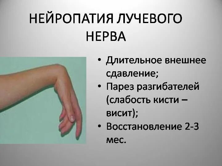 Неврит нейропатия. Нейропатия лучевого нерва. лучевойй нерв нейропати. невропатия локтевого и лучевого нерва. невриты верхних конечностей.