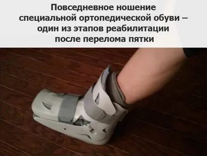 Сломан отзывы