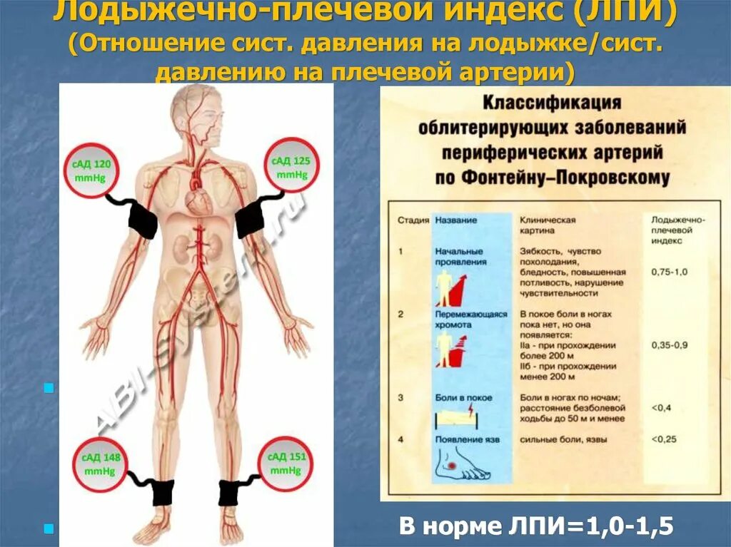 Давление при атеросклерозе