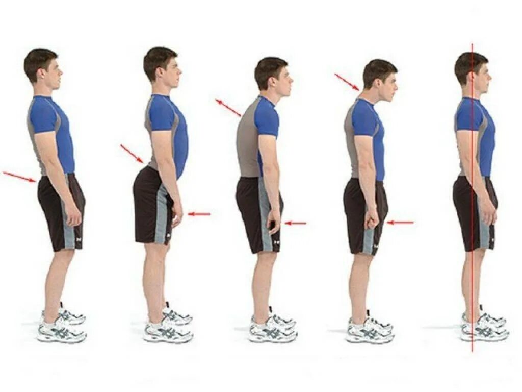 Насколько назад. Лордоз поясничного отдела позвоночника упражнения. Поясничный лордоз упражнения для исправления. Упражнения для выпрямления осанки. Осанка нарушение осанки.