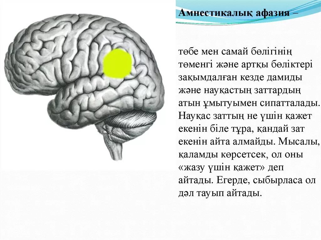 Номинативная функция речи при афазии. Амнестическая афазия. симптомы амнестической афазии. афазия презентация. амнестическая афазия презентация.