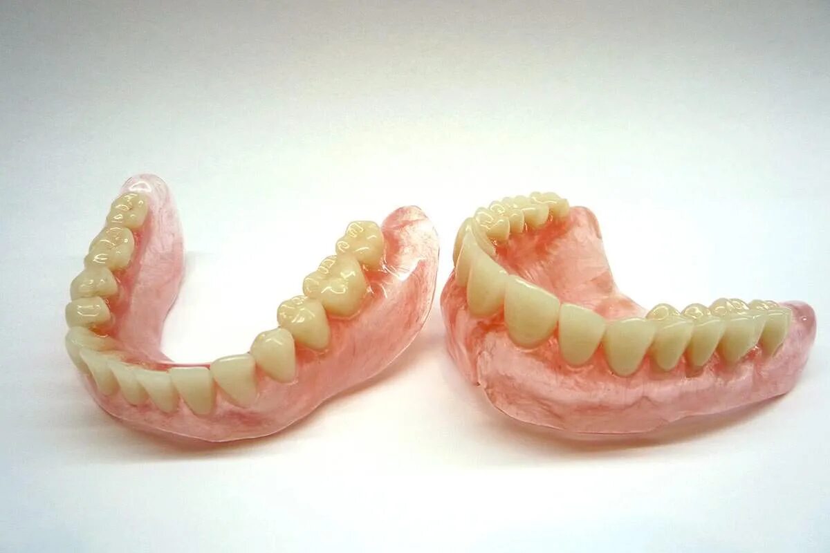 Протезирование зубов в казани. Съёмный протез на нижнюю челюсть. Зубные протезы нового поколения.