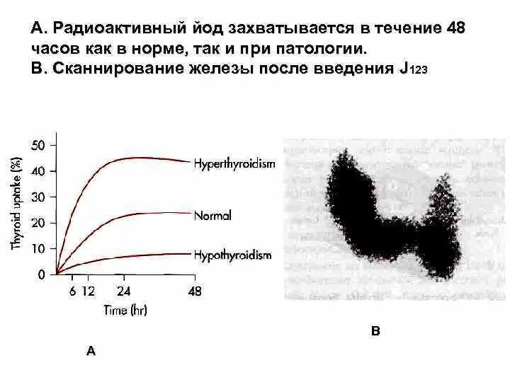 Захват радиоактивного йода щитовидной железой. Захват йода щитовидной железой тест норма. Радиометрия щитовидной железы нормы. Распад йода 131 схема.