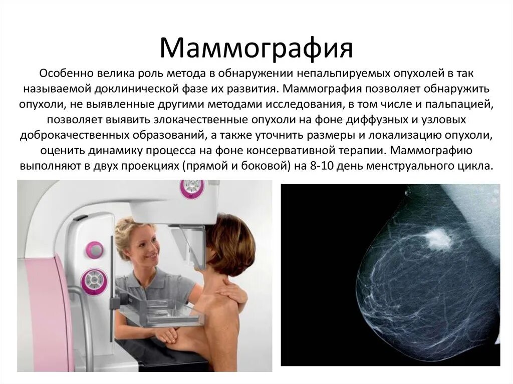 Маммография обязательно. Маммография косая проекция укладка. Маммография молочных желез. Маммография это исследование. Рентгеновская маммография.