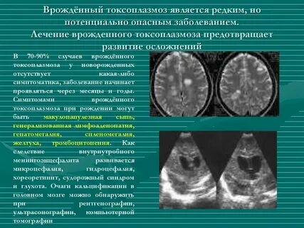 Симптомы токсоплазмоза у человека фото